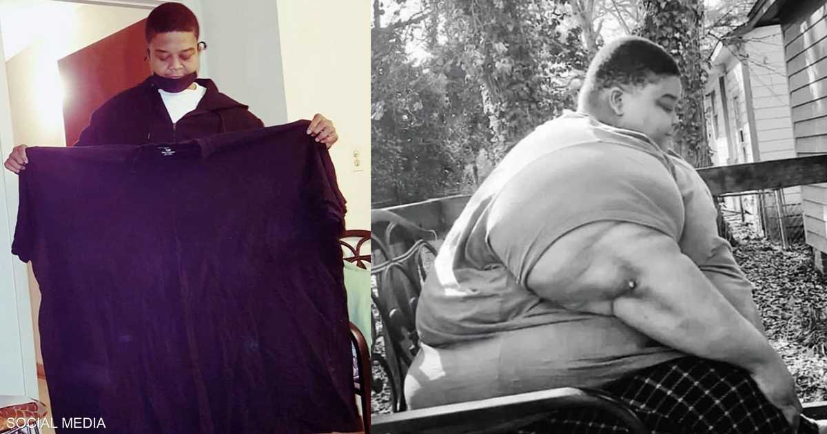 وصفه طبيبه بـ”القنبلة الموقوتة”.. شاب يخسر 165 كيلو من وزنه